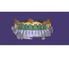 Parça başı uygun monolitik işleriniz yapılır.