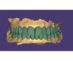 Parça başı uygun monolitik işleriniz yapılır.