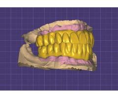 Exocad tasarımcısı