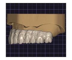 CAD-CAM/Diş teknisyeni - Tam zamanlı veya Uzaktan