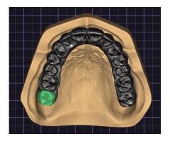 CAD-CAM/Diş teknisyeni - Tam zamanlı veya Uzaktan