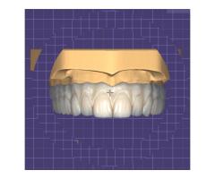 CAD-CAM/Diş teknisyeni - Tam zamanlı veya Uzaktan