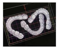 3 SHAPE-EXOCAD TASARIMCI