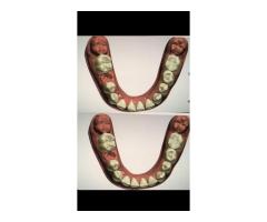 3 SHAPE-EXOCAD TASARIMCI