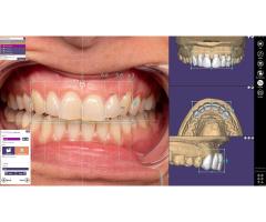 Estetik gülüşlerin dijital tasarımı 👄✨