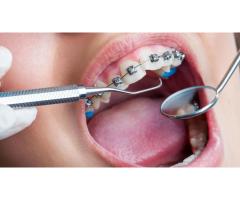 DENEYİMLİ ORTODONTİ UZMANI PART TİME İŞ ARIYOR