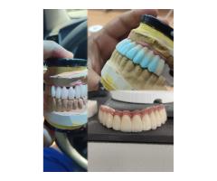 Porselenci İş Arıyor