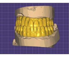 PARÇA BAŞI KAZIMA VEYA TASARIMLARINIZ YAPILIR
