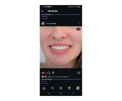 USTA PORSELENCİ- KLİNİK VEYA LAB ARANIYOR