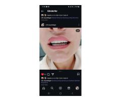 USTA PORSELENCİ- KLİNİK VEYA LAB ARANIYOR