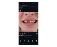 USTA PORSELENCİ- KLİNİK VEYA LAB ARANIYOR