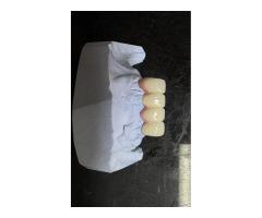 Porselenci iş arıyor