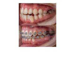 Van ve çevre illerde Ortodonti uzmanı olarak çalışabileceğim klinik arıyorum.