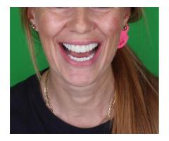 Dijital dental design desteği verilir