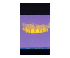 Dijital üye başı tasarım