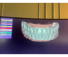 Dijital üye başı tasarım