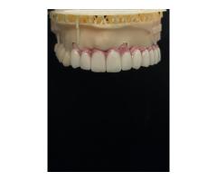 Anadolu yakası makyaj/exocad tasarım